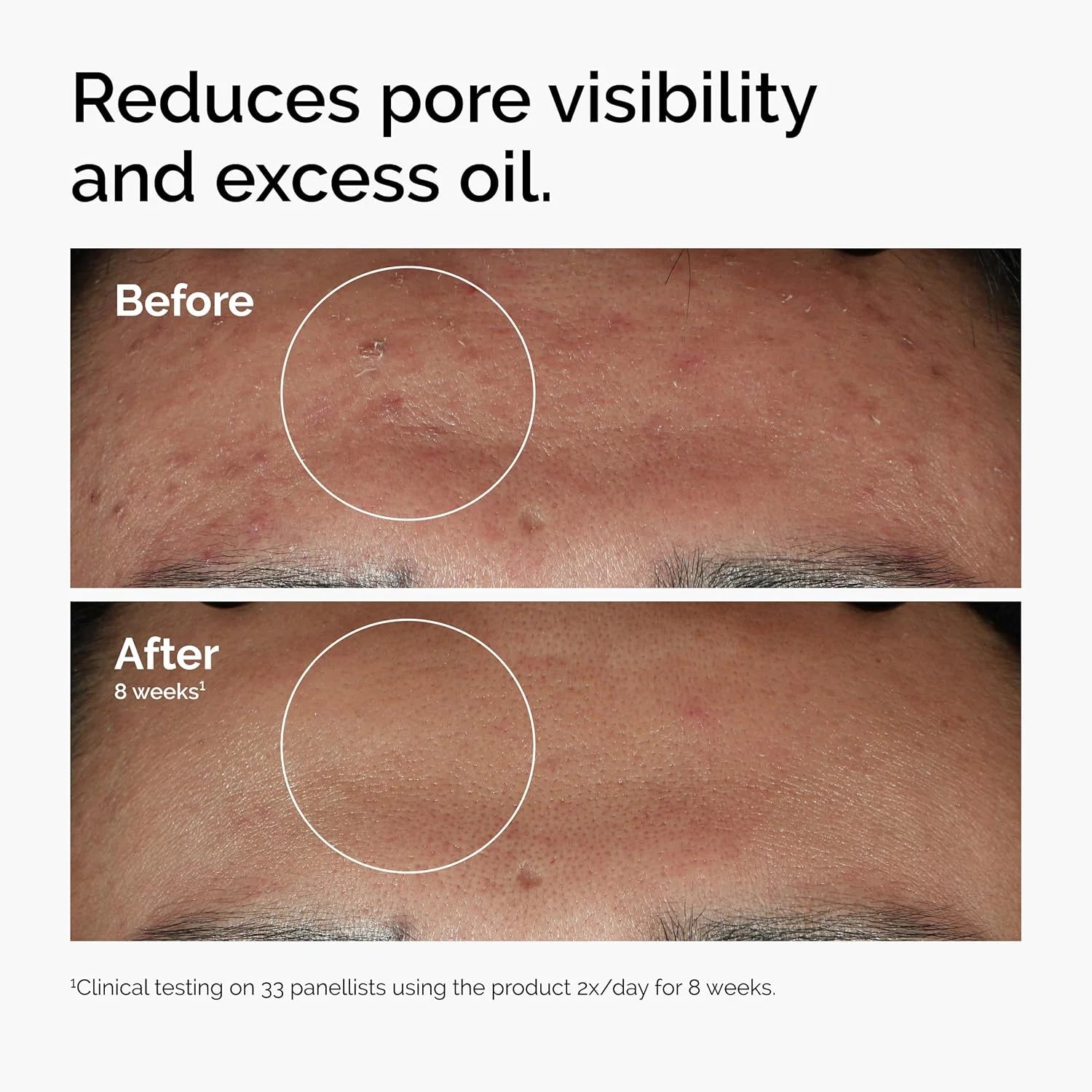 30ml of 10% Niacinamide+1% Zinc, Suitable for Smooth Serum on Skin Prone To Problems, Suitable for Both Men and Women